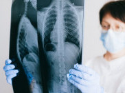Kasus TBC di Indonesia Meningkat, Bukti Sistem Deteksi dan Pelaporan Membaik