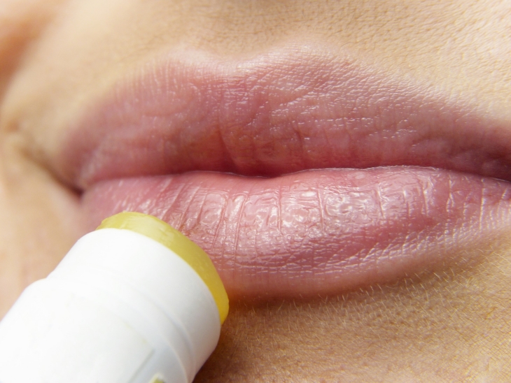 Pemakaian lipbalm berlebihan bisa membuat bibir kering. (Foto: unsplash/silviarita)
