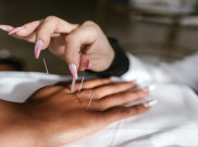 Kurangi Nyeri Masa Menopause dengan Akupunktur