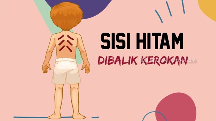 Kerokan Ternyata Tidak Baik, Terutama untuk Ibu Hamil