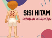 Kerokan Ternyata Tidak Baik, Terutama untuk Ibu Hamil