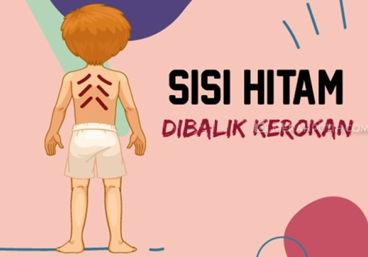 Kerokan Ternyata Tidak Baik, Terutama untuk Ibu Hamil