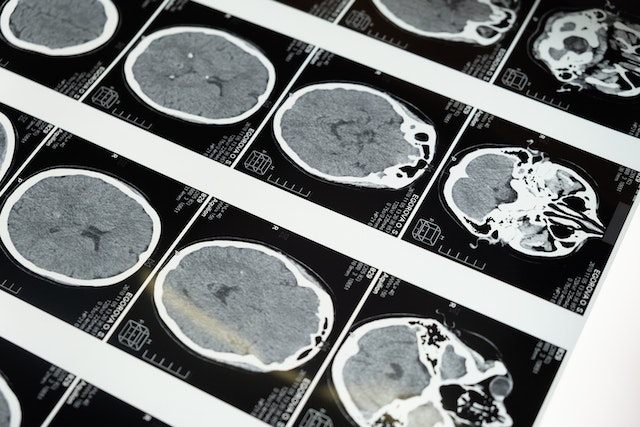 brain