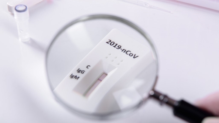 Perbedaan Rapid Test Antibodi dan Antigen dan Kegunaannya