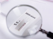 Perbedaan Rapid Test Antibodi dan Antigen dan Kegunaannya