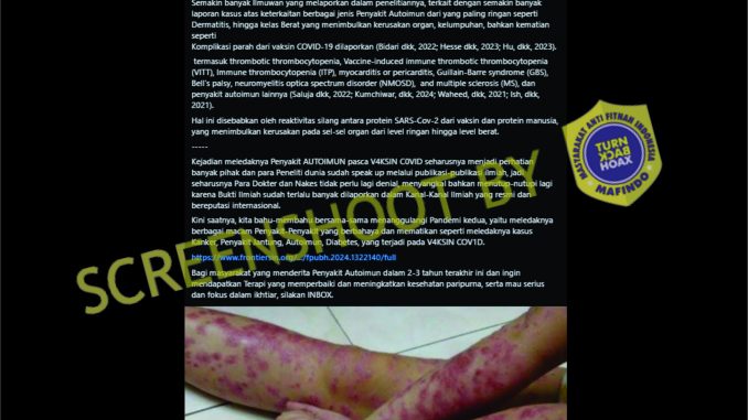 [HOAKS atau FAKTA]: Kasus Autoimun Meroket Akibat Vaksinasi COVID-19