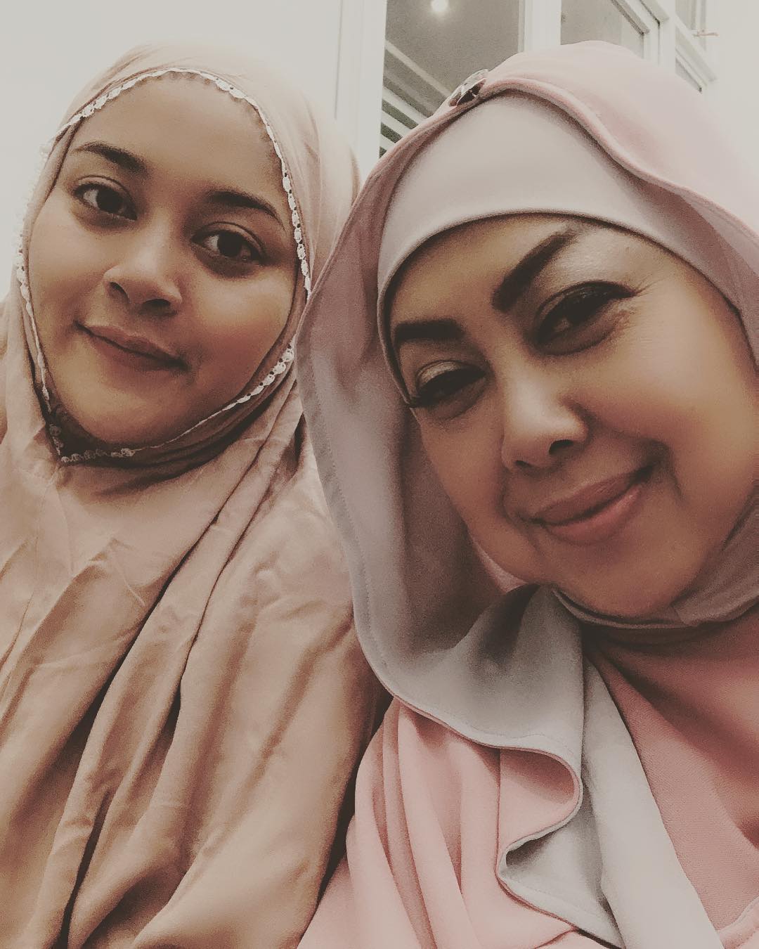 Bukan Hanya Agung Hercules, Deretan Artis Ini Juga Pernah Mengidap Tumor Otak