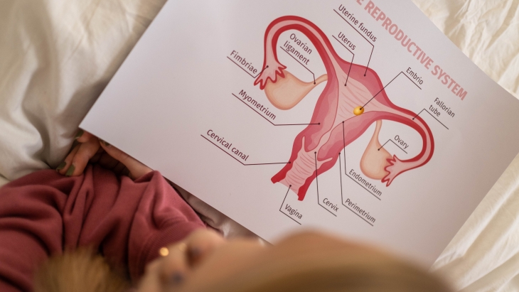 Ladies, Ketahui Berbagai Gejala Kista Ovarium