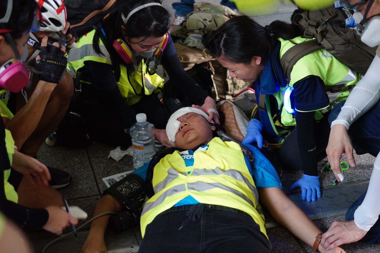 Kondisi Wartawati Indonesia yang Tertembak Peluru Karet di Hong Kong