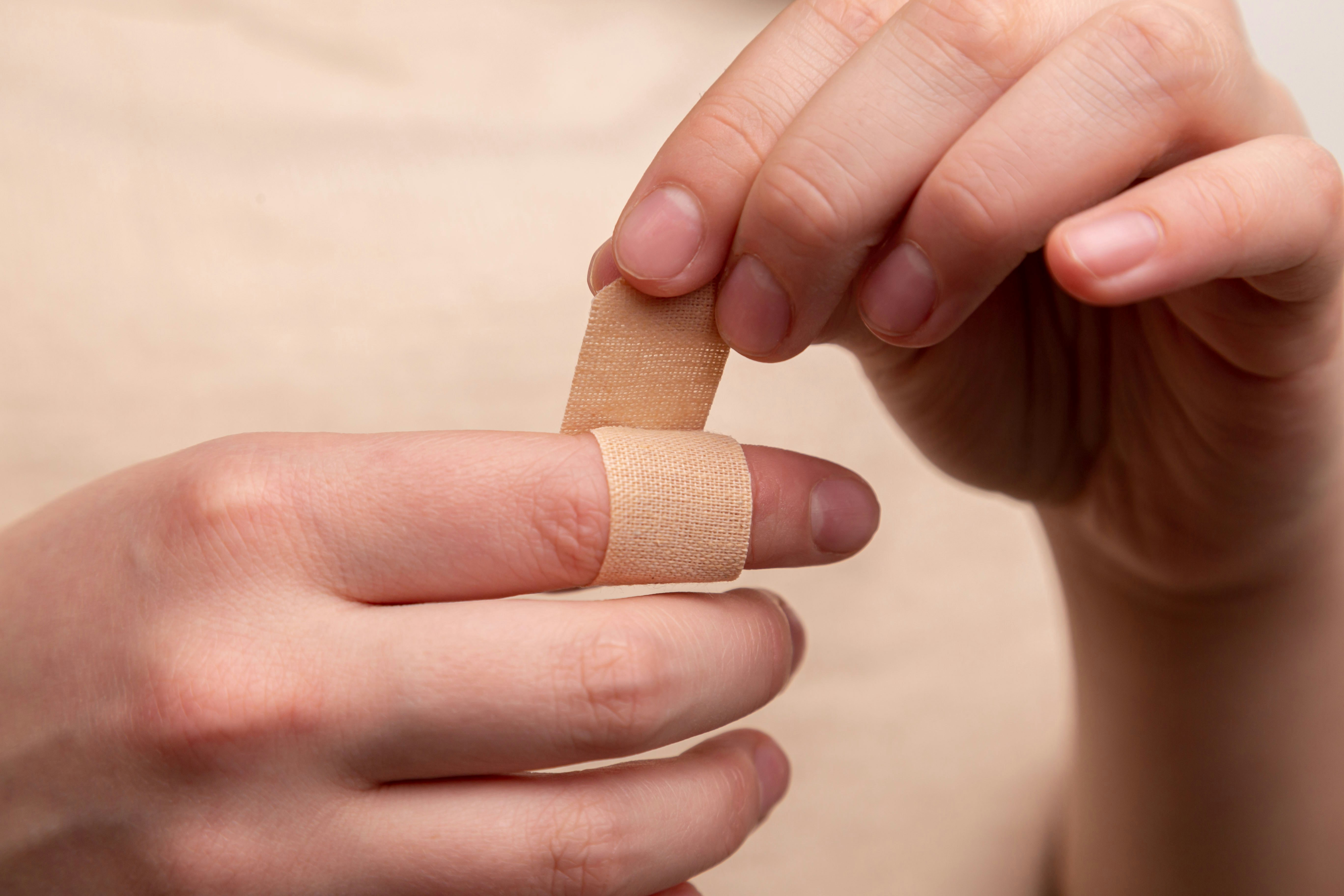 Simpel, 3 Langkah Merawat Luka Biar Cepat Sembuh