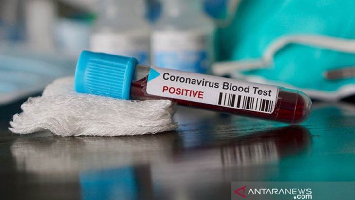 Pemerintah Didesak Atasi Ketertinggalan Pendeteksian Kasus COVID-19