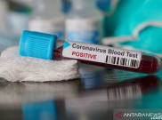Pemerintah Didesak Atasi Ketertinggalan Pendeteksian Kasus COVID-19