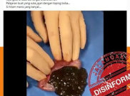 [HOAKS atau FAKTA] Minum Boba Menyebabkan Usus Buntu