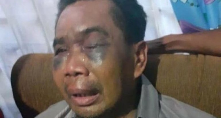 Sarpan, disiksa polisi | Sumber Foto:SinarLampung