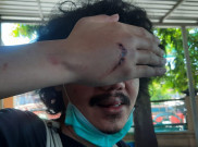 Dituduh Menabrak, Wartawan Online di Surabaya Dianiaya Orang Tak Dikenal