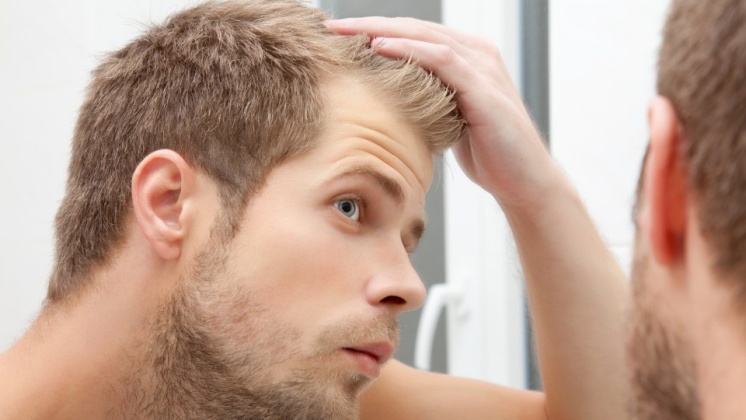 Khawatir Kebotakan dan Rambut Rontok? 10 Makanan ini Bisa Bantu Mencegahnya