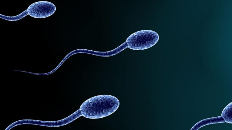 Sperma Berubah Warna Pertanda Penyakit?