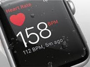 Canggih! Apple Watch Dapat Mengubah Cara Mendiagnosis Penyakit Jantung
