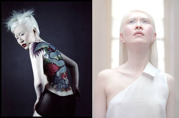 Connie Chiu (albinism.ohchr.org)