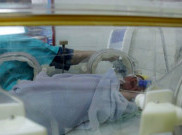 Operasi Pemisahan Bayi Kembar Siam di  RSUP M. Djamil Padang