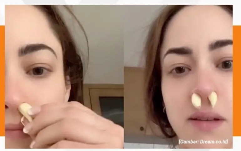 [HOAKS atau FAKTA]: Sumbat Hidung Pakai Bawang Putih Bisa Sembuhkan Sinusitis