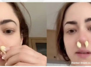 [HOAKS atau FAKTA]: Sumbat Hidung Pakai Bawang Putih Bisa Sembuhkan Sinusitis