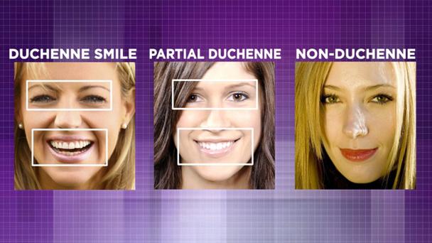 Duchenne Smile