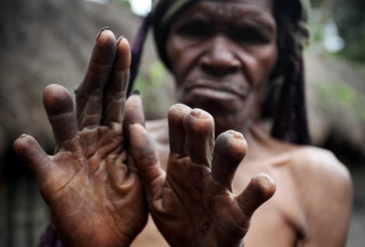 Tradisi Ekstrem Suku Dani Papua Ketika Bersedih