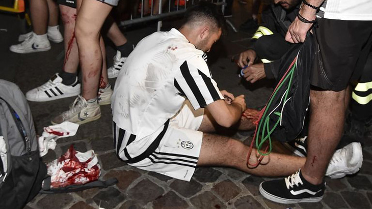 Ratusan Pendukung Juventus Luka-luka Saat Nobar Liga Champions