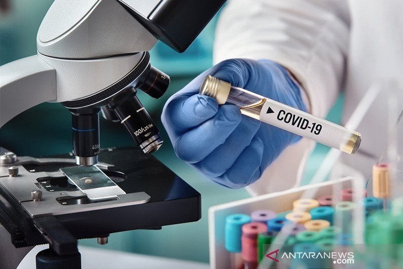 Update Kasus Corona DKI Jumat (14/8): 28.438 Positif, 18.528 Sembuh