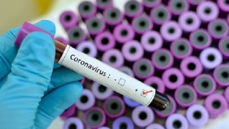 Pemprov DKI: 20.532 Orang Lakukan Rapid Test, 428 Dinyatakan Positif COVID-19