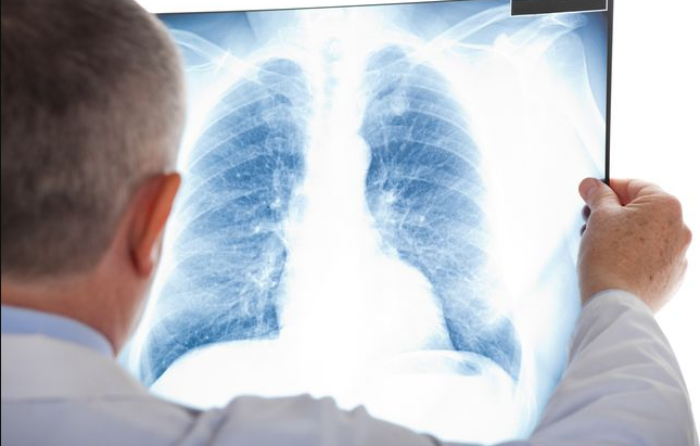 Kemendikbud Keluarkan Edaran Kesiapsiagaan Pencegahan Penyakit Pneumonia