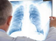 Kemendikbud Keluarkan Edaran Kesiapsiagaan Pencegahan Penyakit Pneumonia