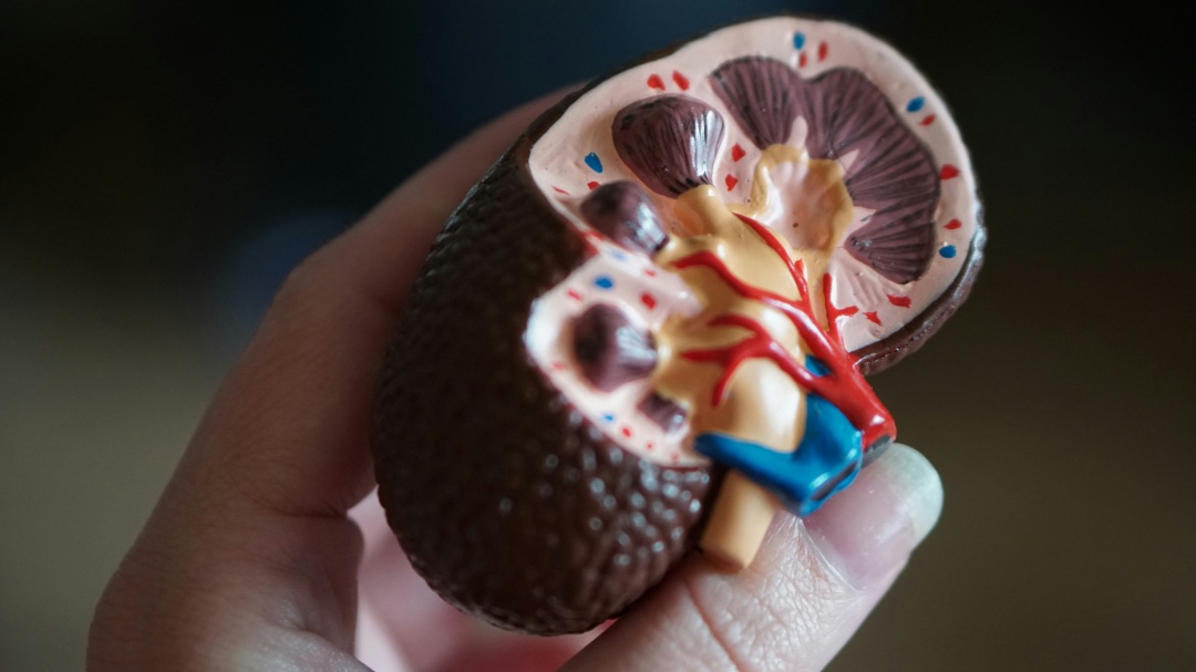 Minum Air Cukup untuk Hindari Batu Empedu