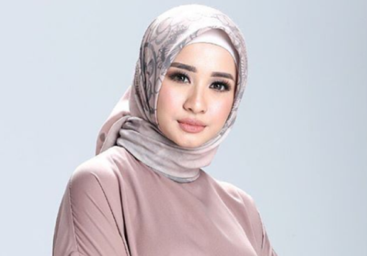 Unggahan Instagram Pertama Laudya Cynthia Bella di 2018 Bikin Gagal Fokus