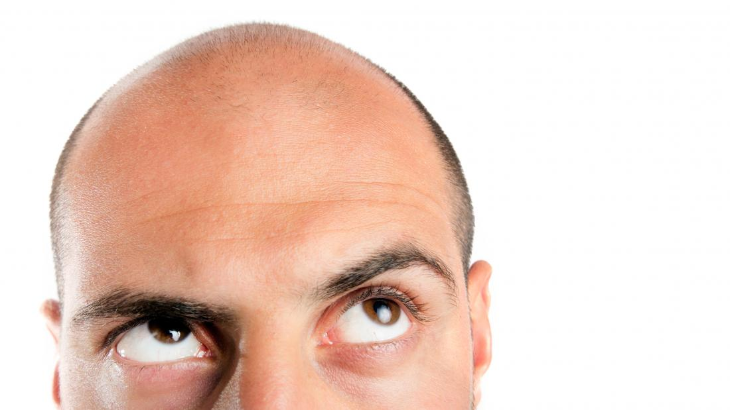 Enggak Panas, Minyak Goreng Malah Bisa Menumbuhkan Rambut