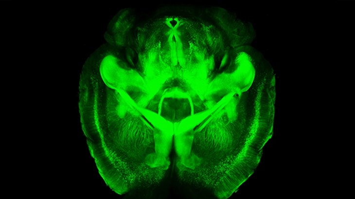 Cuci otak metode yang menyembuhkan stroke. (Foto: engineering stanford)