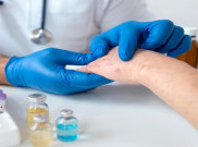 Obat Antivirus Cacar Monyet Masuk Tahap Uji Coba