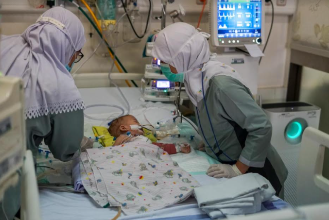 Bayi kembar siam selesai jalani operasi di RSHS Bandung. (Foto: RSHS)