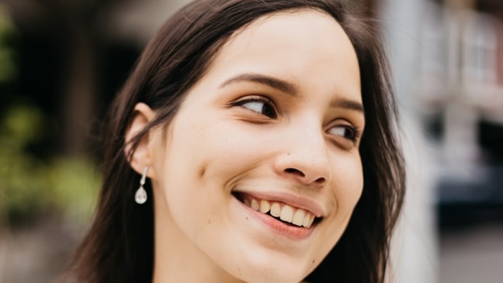 Cantik, Lesung Pipi Ternyata Sebuah Kelainan 