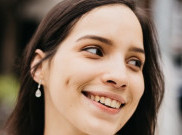 Cantik, Lesung Pipi Ternyata Sebuah Kelainan 