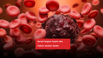 Kenali Segera Gejala dan Faktor Kanker Darah