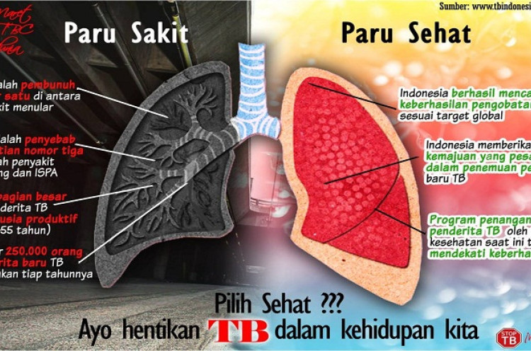 Ini Cara Orang Tua Dulu Mengobati Penyakit TBC