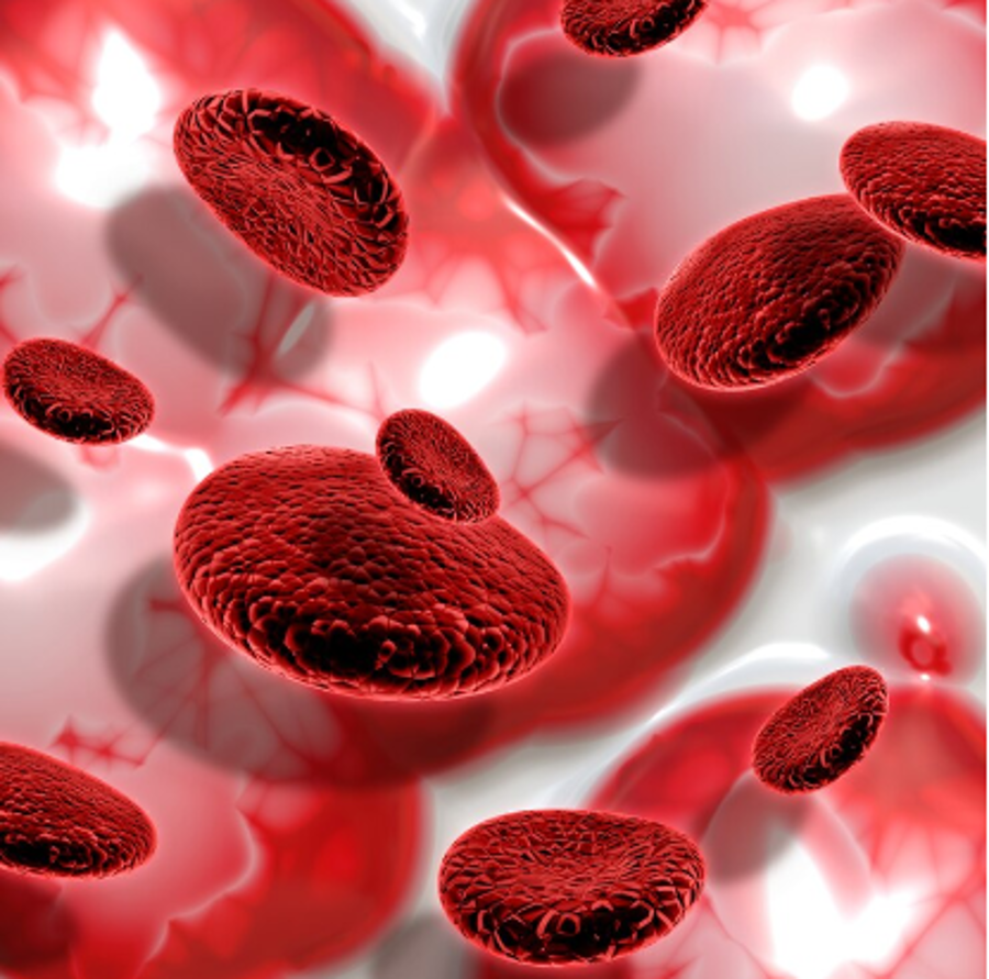 Apa Itu Anemia? Penyebab, Gejala, dan Cara Mengatasinya