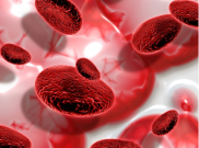 Apa Itu Anemia? Penyebab, Gejala, dan Cara Mengatasinya