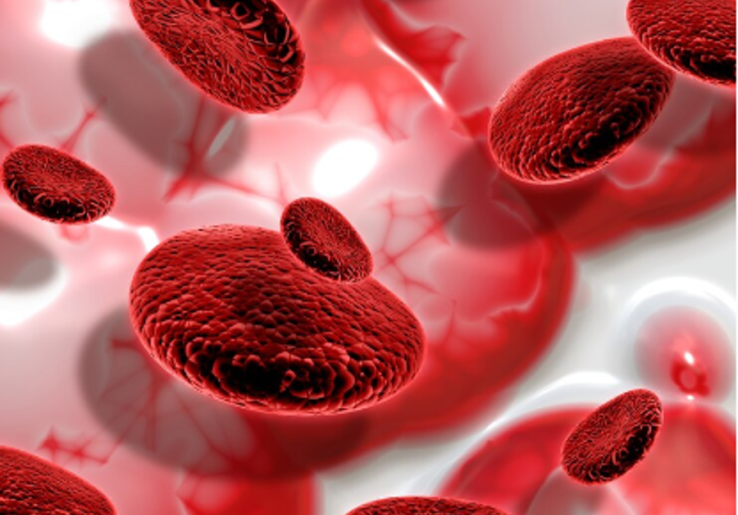 Apa Itu Anemia? Penyebab, Gejala, dan Cara Mengatasinya