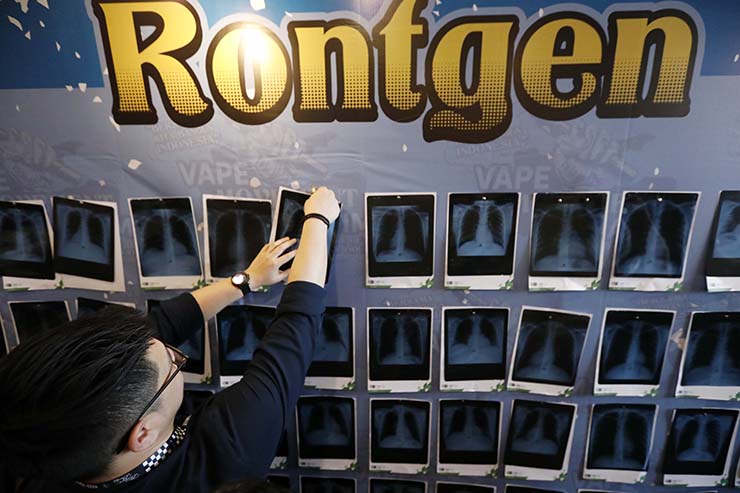 Ratusan Vapers Pamerkan Hasil Rontgent Paru-paru, Vape Lebih Bahaya dari Rokok?