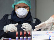  Hasil Rapid Test Terbaru, 99 Warga Yogyakarta Positif COVID-19