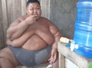 Pemuda Asal Sragen Alami Obesitas 165 Kilogram, Hanya Bisa Rawat Jalan