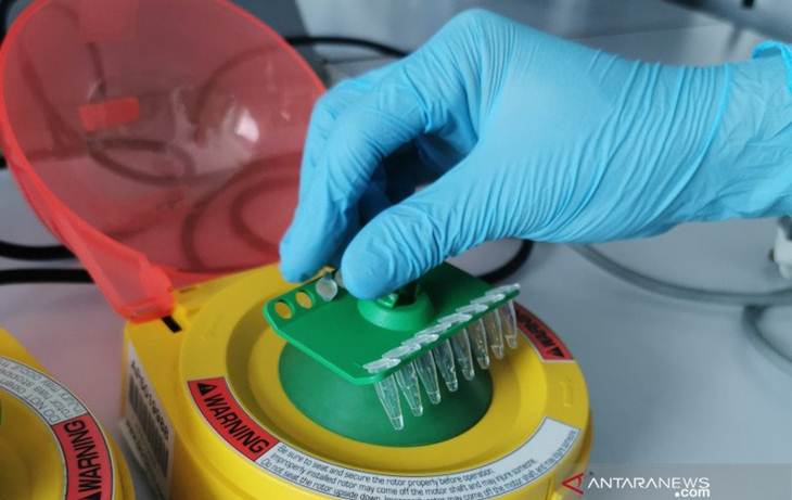 Staf menguji purwarupa (prototipe) test kit qPCR COVID-19 buatan Indonesia. (ANTARA/HO)
